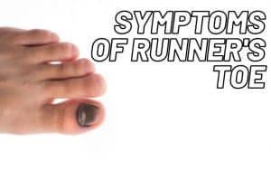 5 Ways To Prevent And Treat Runner's Toe: Get Back Running