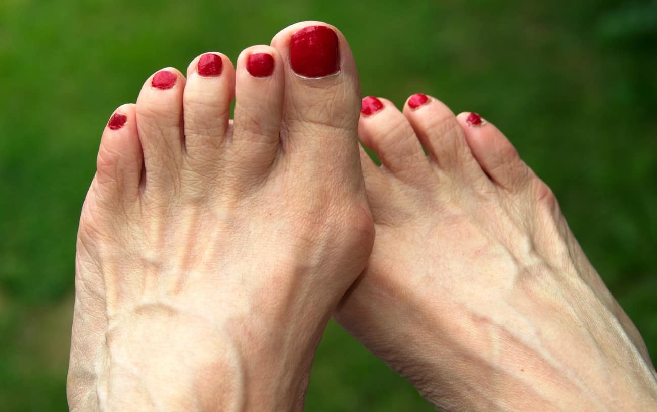 Do Toe Separators Actually Help Runners? - InsideHook