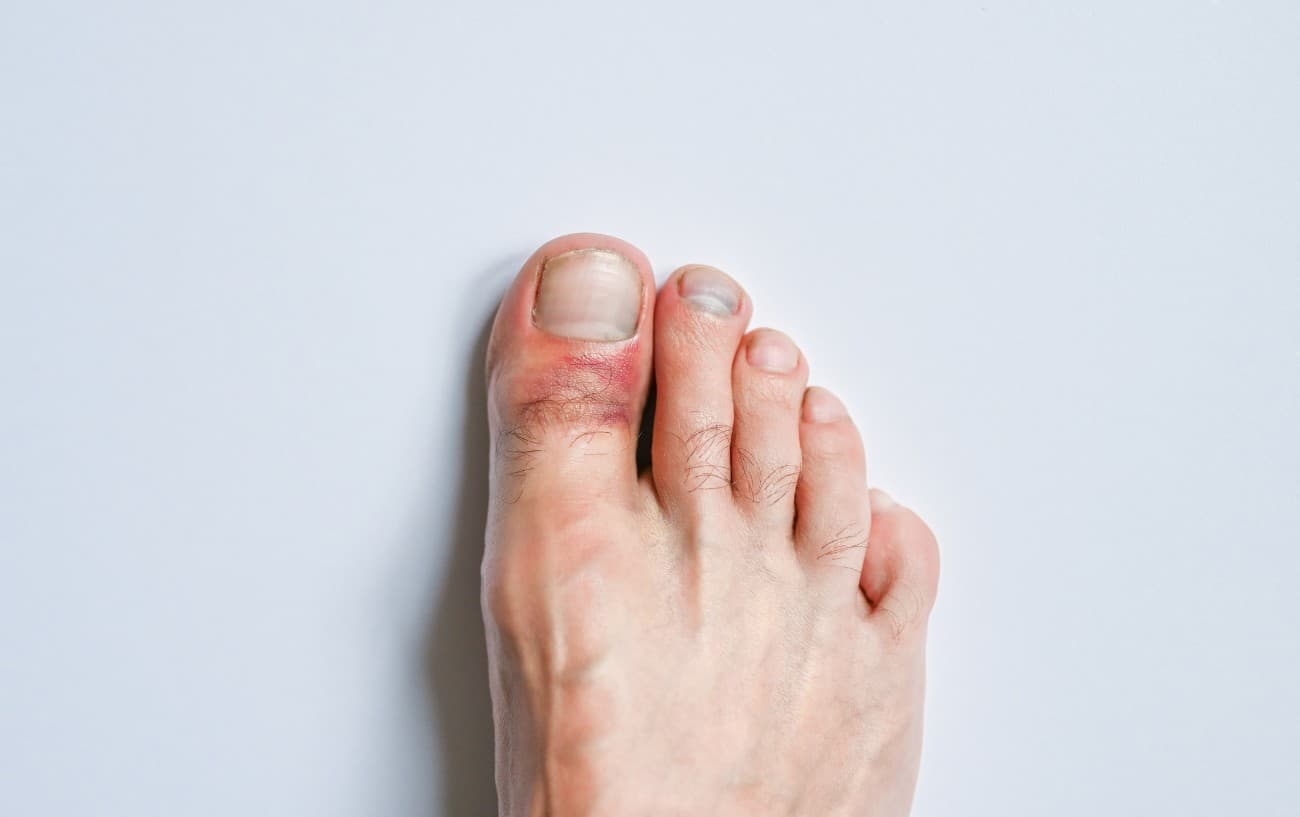 Why Does My Big Toe Hurt?