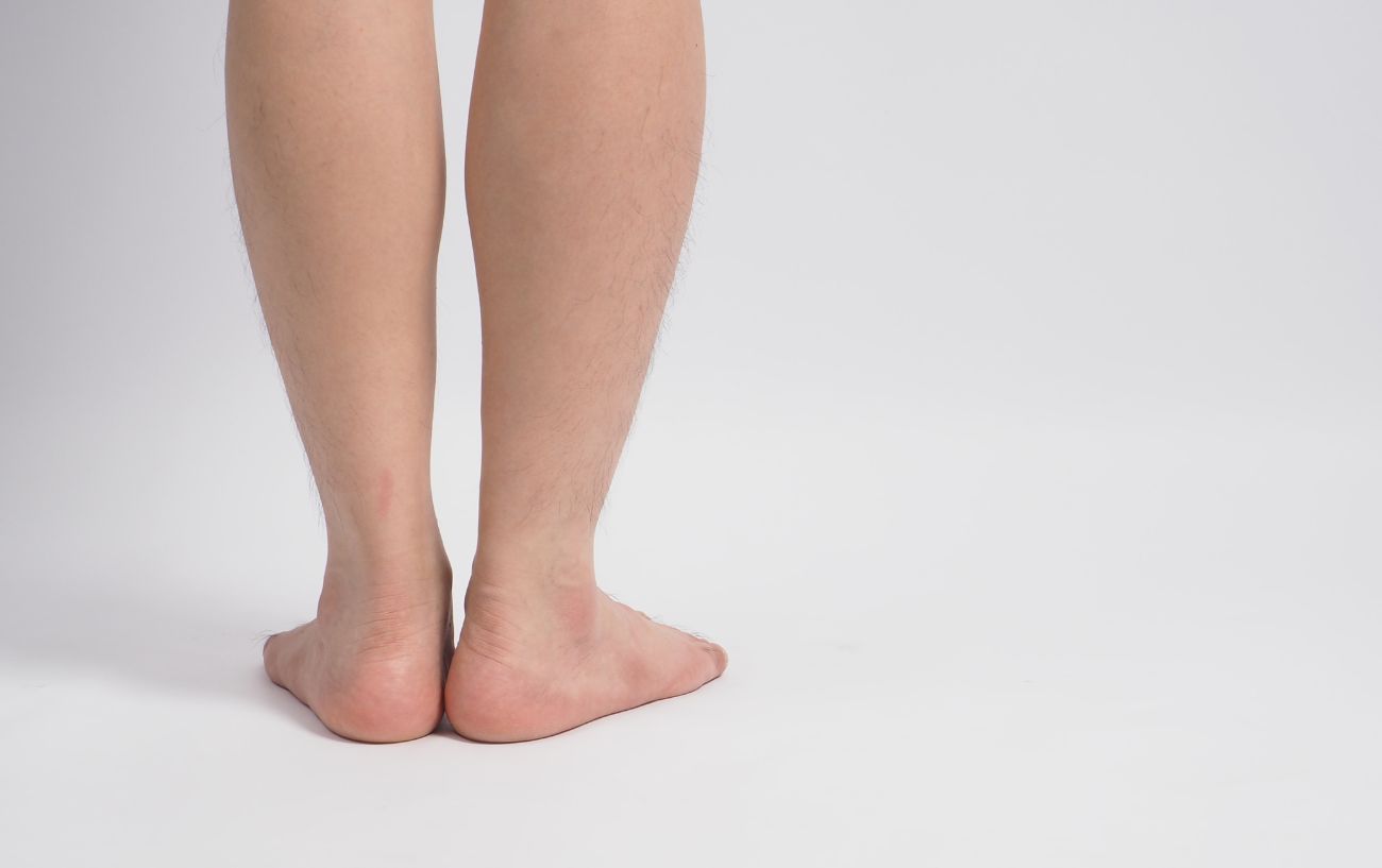 How To Fix Duck Feet 10 Exercises To Improve Posture