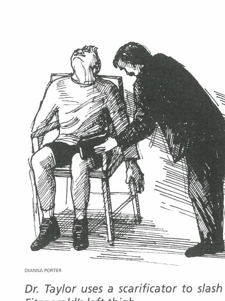The Great Six-Day Races 15 Dr. Taylor uses a scarificator to slash into Fitzgerald's left thigh.