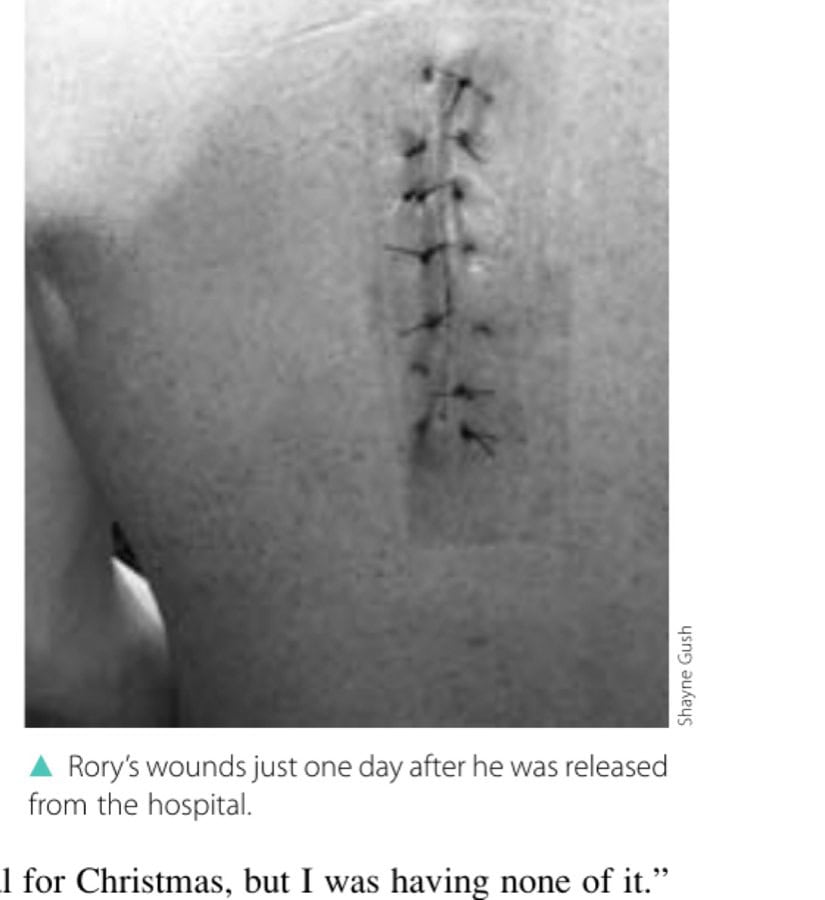 ▲ Rory's wounds just one day after he was released from the hospital.