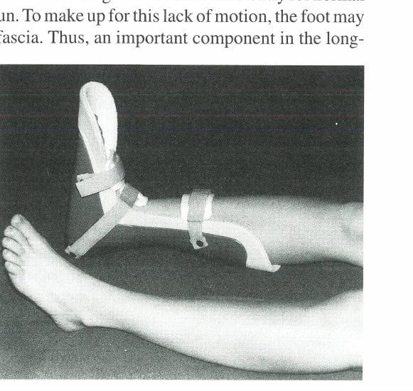 Figure 3: Dorsiflexion splint