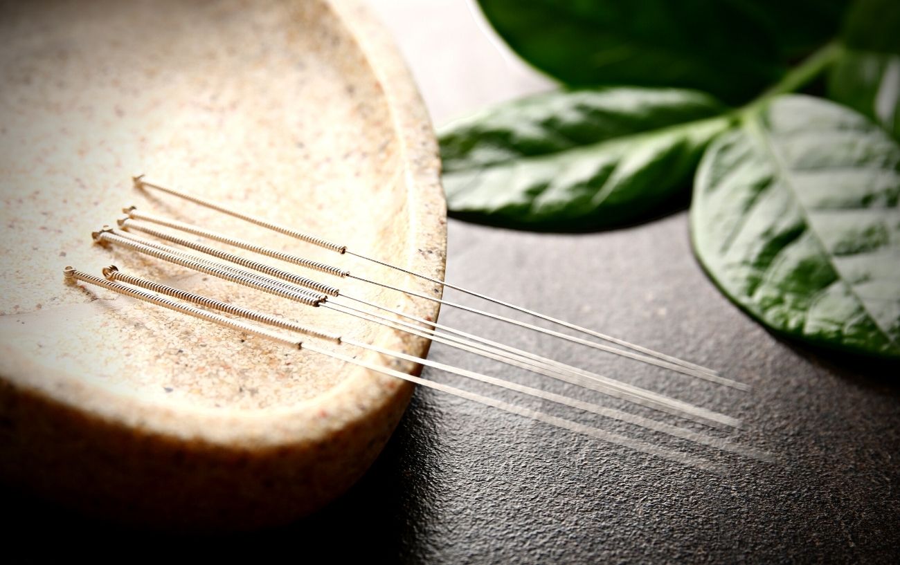 Acupuncteur Stock Photos and Images - 123RF