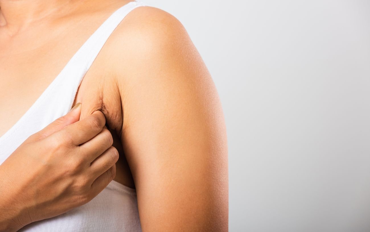 Armpit Chafing: How Does it Happen and Ways to Prevent It – Skineasi