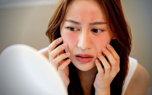 Finally Understand Why Is My Face Always Red After Running And Get Rid Of The Red - hqjmhkq