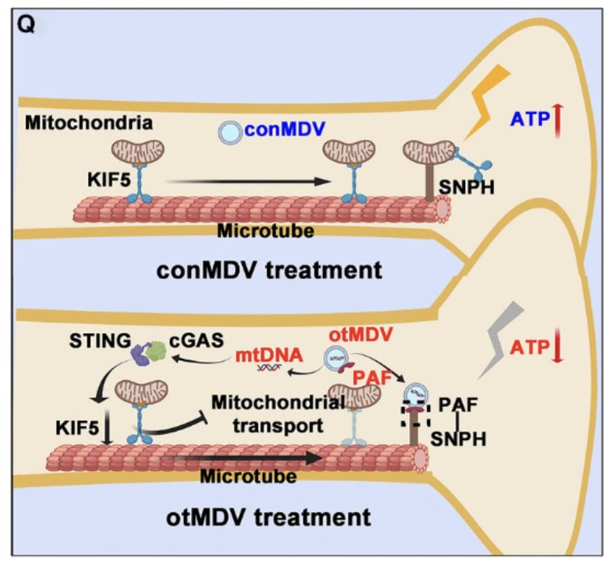 When Hard Training Backfires: Can You Push Intensity Too Far For Your Brain? 4