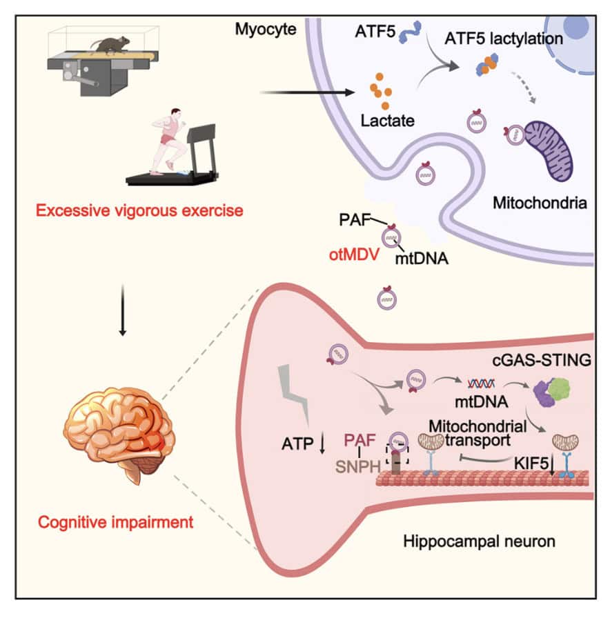 When Hard Training Backfires: Can You Push Intensity Too Far For Your Brain? 6