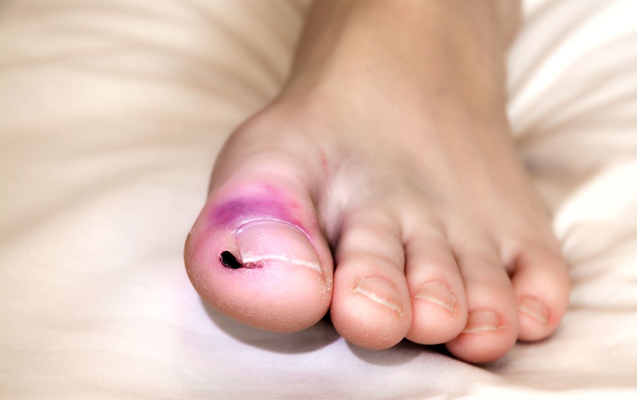 This Is Why Stubbing Your Toe Hurts So Much