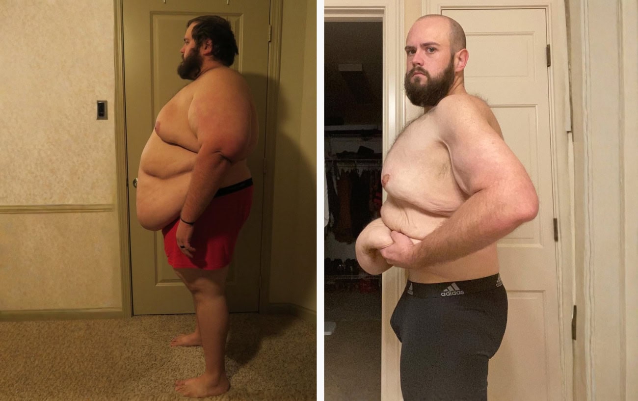 christopher hasty before and after